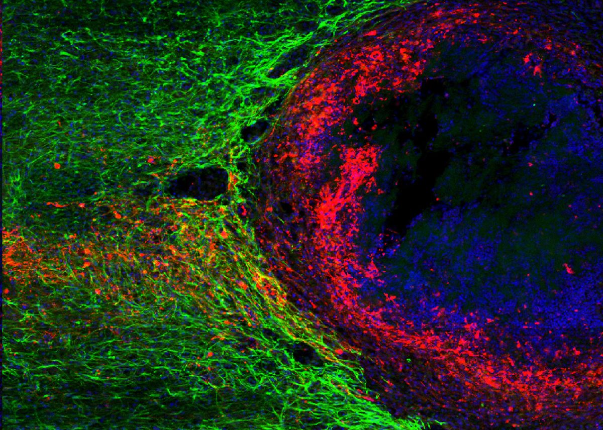 Spinal cord regeneration
