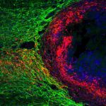 Spinal cord regeneration