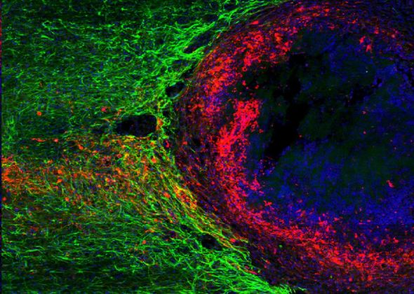 Spinal cord regeneration