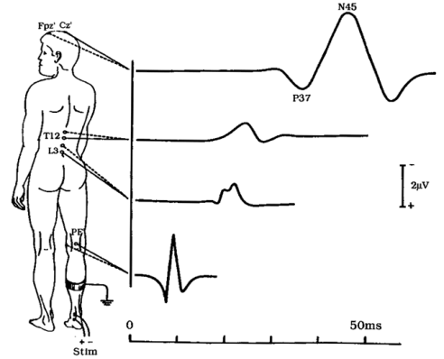 Tibial nerve SEP generating a distinct waveform at the spinal cord (L3, T12), and the brain (Cz) in the body