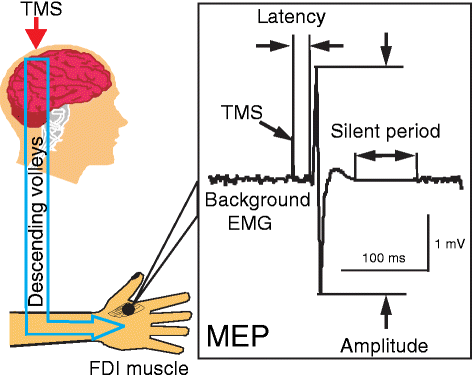 transcranial magnetic stimulation to induce a motor evoked potential