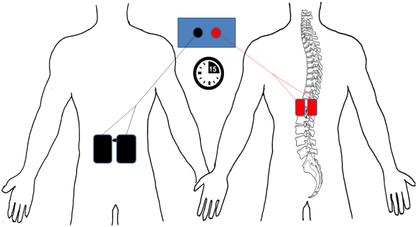 Electrode montage for tsDCS