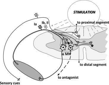 Spinal cord stimulation diagram