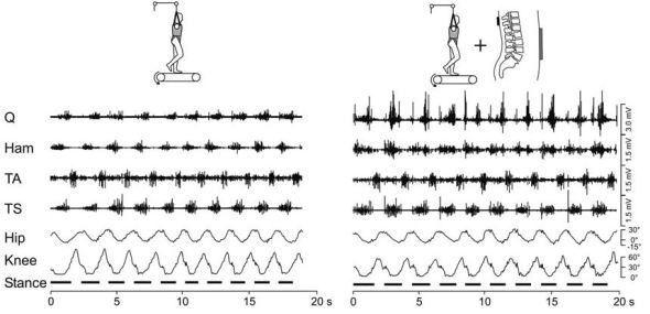 Person walking unaided (left) and in the presence of spinal stimulation (right)