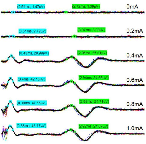 Example processed nerve responses during stimulation trials.