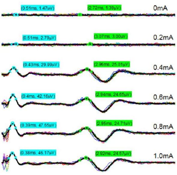 Example processed nerve responses during stimulation trials.