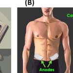 Experimental Setup and tSCS electrode placement (A) H-reflexes were evoked via stimulation of the tibial nerve and recorded in the soleus muscle during a consistent background contraction of ≈5% peak muscle activity. The left leg was held static in an extended position, and stimulation to evoke the H-reflex was delivered with the left arm at 0°. (B) tSCS was delivered via two 2.5 cm round cathodic electrodes placed midline at C3-4 and C6-7 (cervical) or T11 and L1 (lumbar) spinous processes. Two 5 × 10 cm rectangular anodic electrodes were placed bilaterally over the iliac crests.