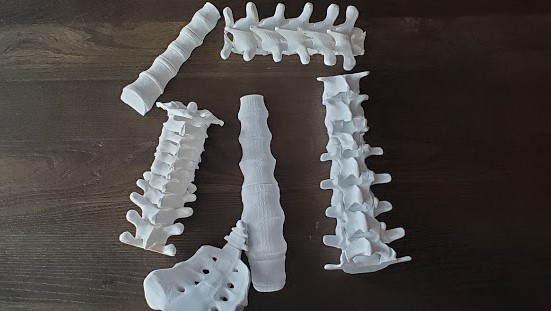 3D printed spinal column still in parts getting ready for cleaning and assembly.